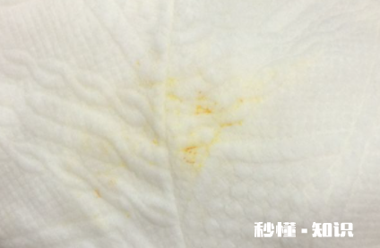 黄色花粉怎么洗 怎么去掉花粉的颜色