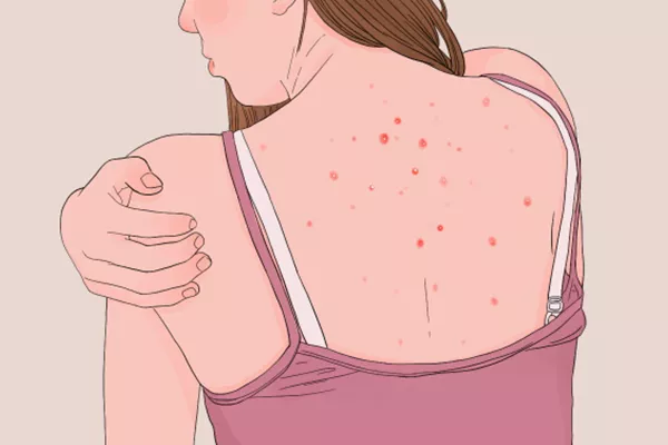 生菜有哪三大禁忌 生菜的功效与作用