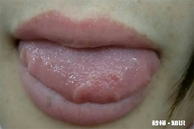 吃无花果一天吃几颗 吃无花果一天吃几颗合适