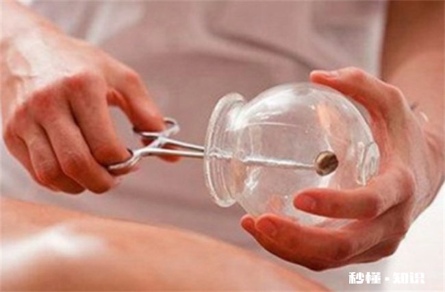 拔罐时哪些事项要注意 拔罐的注意事项是什么