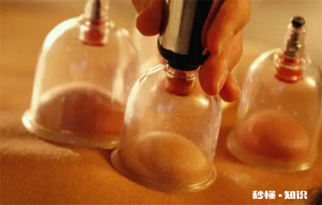 拔罐时哪些事项要注意 拔罐的注意事项是什么