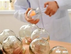拔罐时哪些事项要注意 拔罐的注意事项是什么