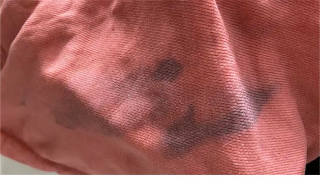 石榴汁弄衣服上变什么颜色 石榴的颜色弄到衣服上怎么办