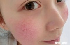 早c晚a为什么越用越黑 早c晚a为什么越用越黑黄