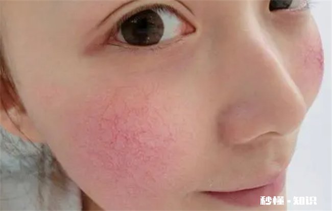 早c晚a为什么越用越黑 早c晚a为什么越用越黑黄