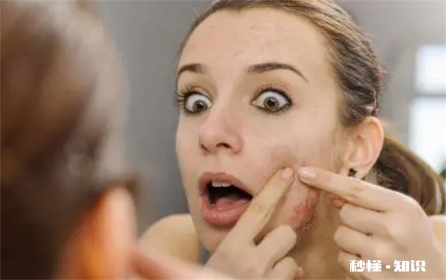 脸上长痘痘如何消除 男生脸上长痘痘如何消除