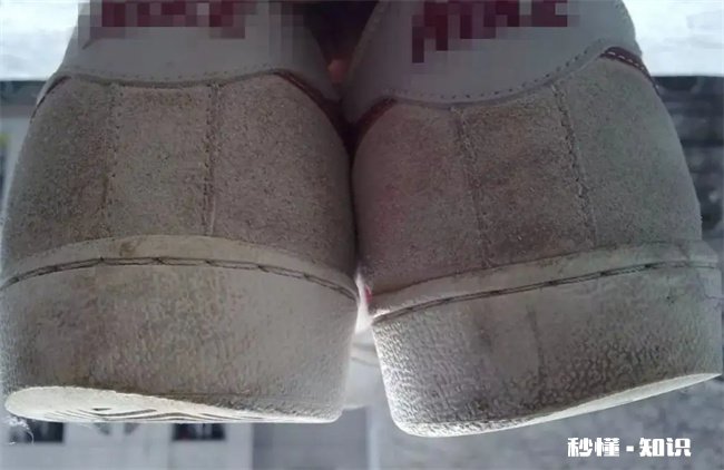 鞋子磨损能看出身体情况吗 鞋子磨损能看出身体情况吗图片