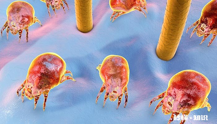 螨虫怎么杀死 怎样杀螨虫最有效的方法