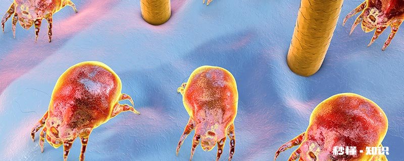 脸上怎么去除螨虫 脸上好多螨虫怎么去除