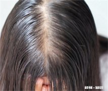 爽身粉擦头发有危害吗 爽身粉擦头发可以去油吗