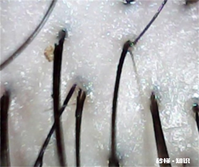 爽身粉擦头发有危害吗 爽身粉擦头发可以去油吗