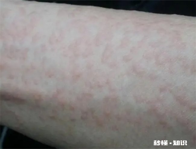 房间喷了杀虫剂床单要换吗