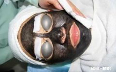 黑脸娃娃的危害是什么