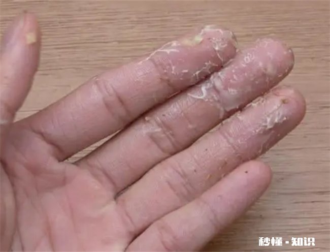 菠萝蜜的胶粘在手上怎么洗掉