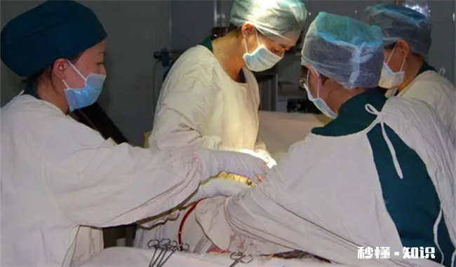 取环时疼吗有30年了