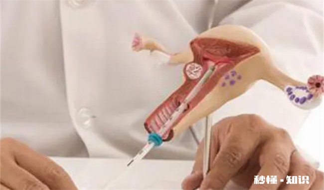 取环时疼吗有30年了