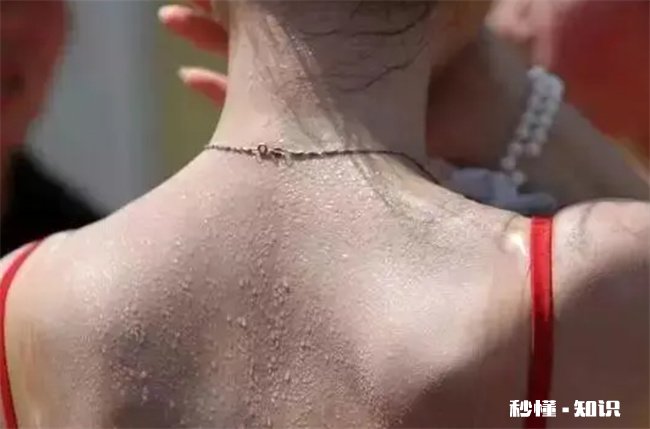 三伏天晒背后的排病反应