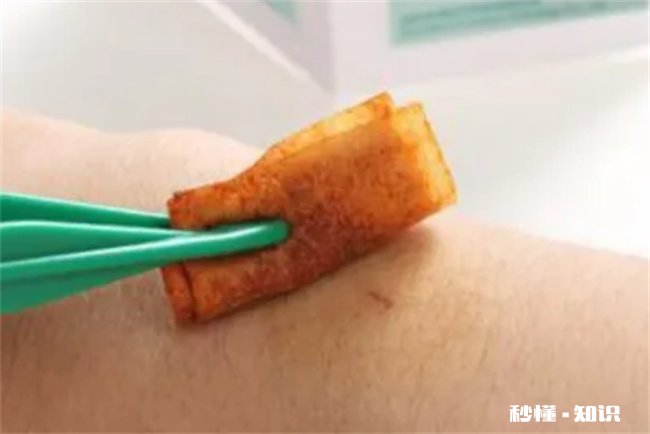 家养狗咬伤有必要打针么