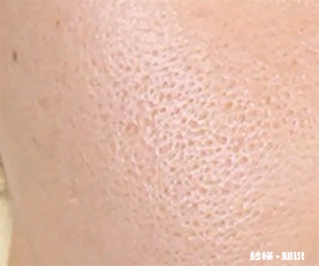 为什么医生不建议涂防晒霜