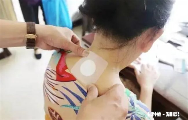 三伏灸可以调理什么病