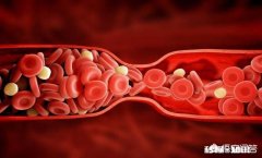 当身体中的血液变得粘稠时会有什么信号，如何能疏通血管、改善粘稠度