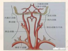 脑供血不足，排除颈椎及心脏，最有可能是什么原因造成的