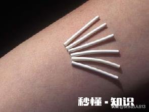 夫妻是一方结扎好，还是做好避孕措施好