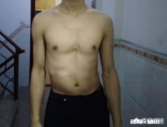 腰脱有什么症状