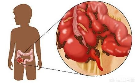 哪些食物是“通便王”，能轻松通便清肠，再也不便秘