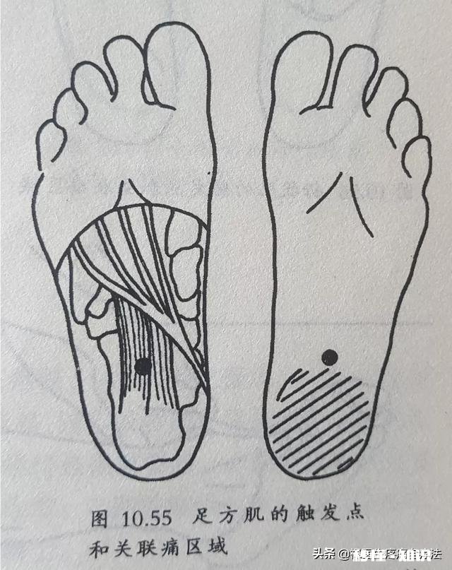 早晨落地第一脚疼痛难忍，医生查出跟骨骨刺，患者将来还能走路吗