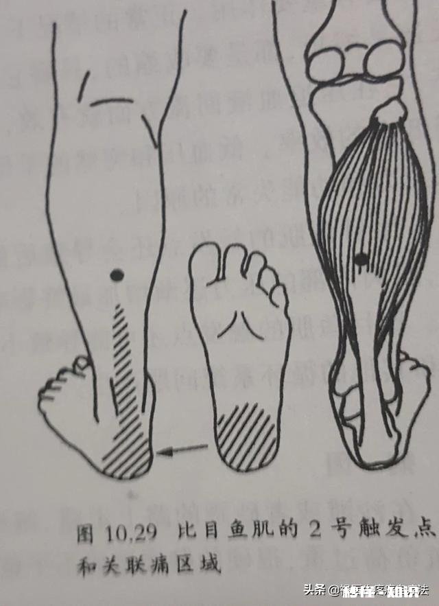早晨落地第一脚疼痛难忍，医生查出跟骨骨刺，患者将来还能走路吗