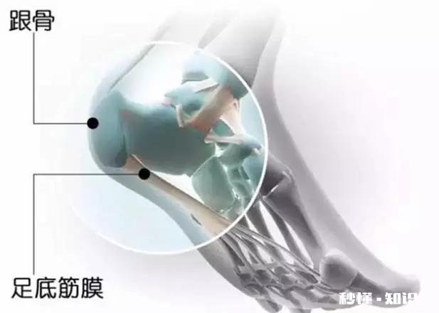 早晨落地第一脚疼痛难忍，医生查出跟骨骨刺，患者将来还能走路吗