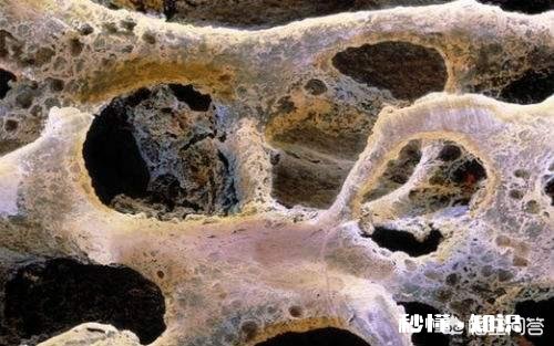 乳腺癌出现骨转移有什么感觉