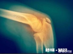 乳腺癌出现骨转移有什么感觉