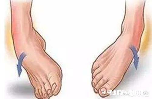 踝关节扭伤之后，如何快速恢复其运动功能