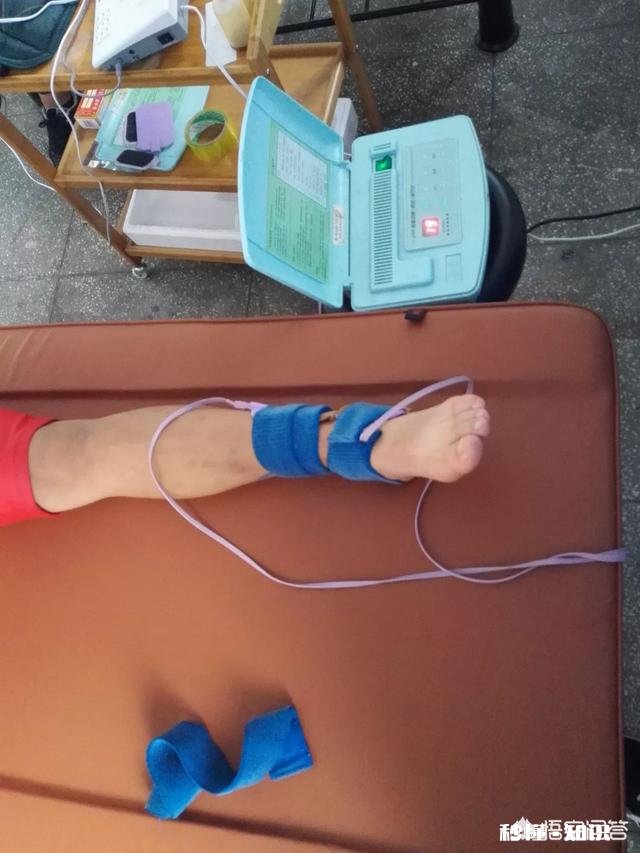 踝关节扭伤之后，如何快速恢复其运动功能