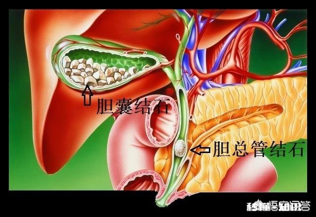 上腹痛一定是胃溃疡吗如何区分十二指肠溃疡和胃溃疡