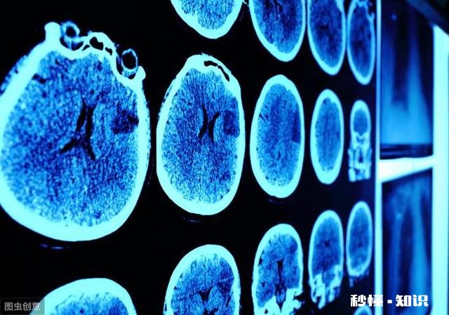 医师说:脑梗的加速器不止是酒,还有哪几种食物如何预防脑梗