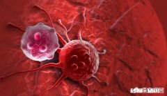 植物人会患癌症吗如果一个癌症患者变成植物人后，他身上的癌细胞会有哪些变化