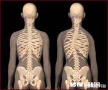 我就是高低肩长短腿是外伤引起能治吗