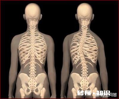 我就是高低肩长短腿是外伤引起能治吗