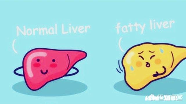 脂肪肝患者减肥需要注意些什么