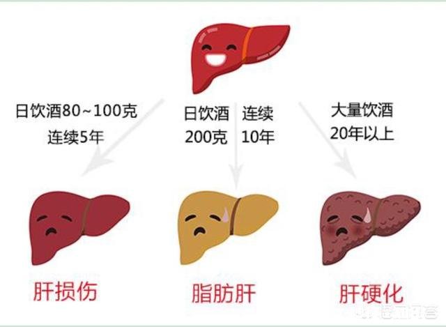 脂肪肝患者减肥需要注意些什么