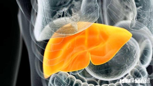 脂肪肝患者减肥需要注意些什么