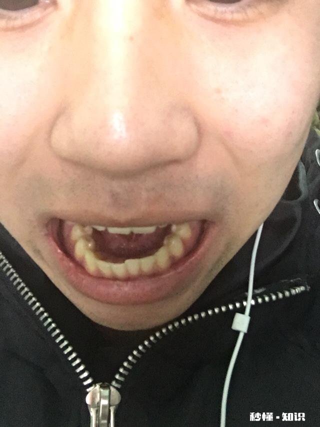 “箍牙变脸”真的有用吗