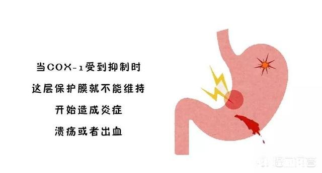 胃溃疡喜欢“缠上”这3类人，是指哪三类人