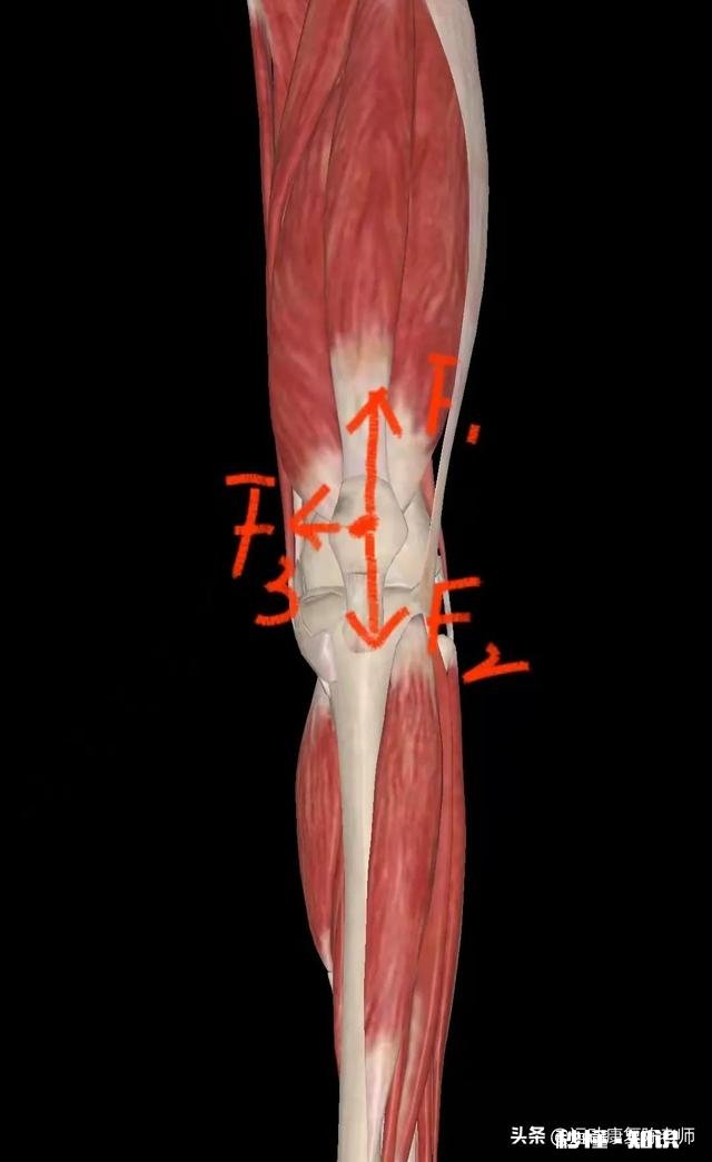 x型腿如何通过运动矫正