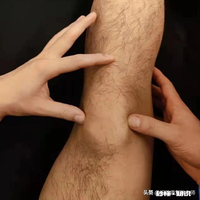 x型腿如何通过运动矫正