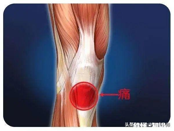 x型腿如何通过运动矫正