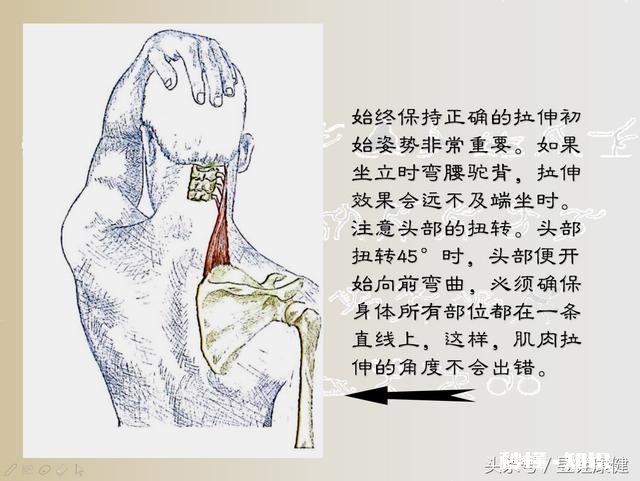 颈部僵硬应该怎么办